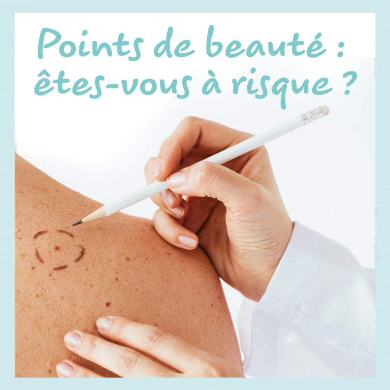 Les points de beauté, êtes-vous à risque ? - Cabinet médical Saint Ex Wavre